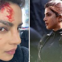 হলিউড সিনেমার শুটিংয়ে কপাল ফাটলো প্রিয়াঙ্কার