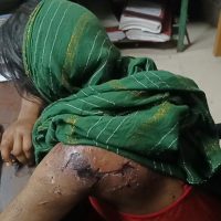 পৈশাচিক নির্যাতনের শিকার ভাগ্নি, মামা-মামি আটক