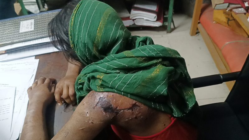 পৈশাচিক নির্যাতনের শিকার ভাগ্নি, মামা-মামি আটক