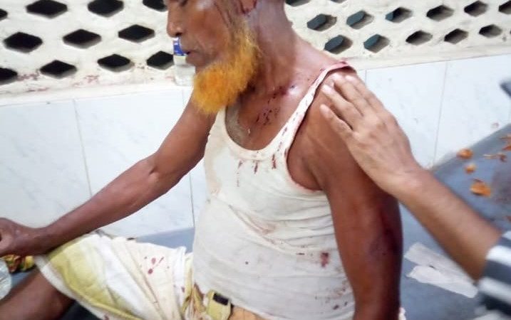 বড়াইগ্রামে আ’লীগের দুই গ্রুপের পাল্টাপাল্টি হামলা, ১ জনের মৃত্যু