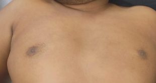 বীরগঞ্জে জমি নিয়ে বিরোধ, প্রতিপক্ষের আঘাতে নিহত-১, গ্রেফতার-১