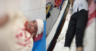 প্রকাশ্য দিবালোকে বাবা ছেলেকে কুপিয়ে হত্যার চেষ্টা তদন্তে পুলিশ